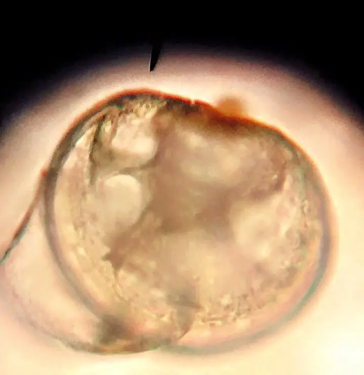 A magnified translucent biological specimen with rounded internal structures and a dark tapered projection.